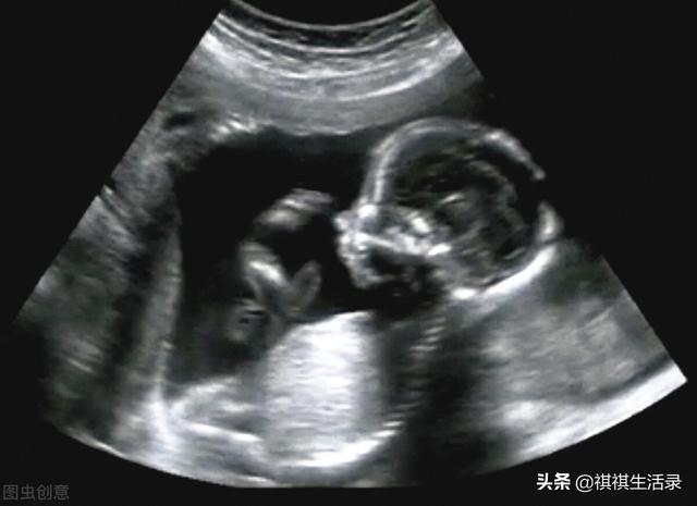 新手爸妈看见胎儿思维图像，先别哭，或许有反转