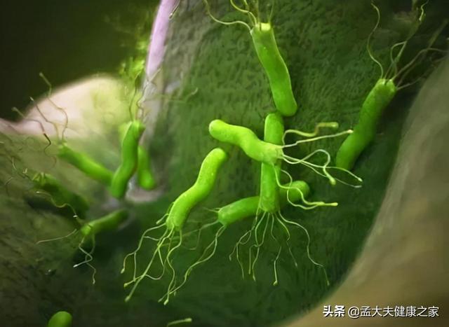 胃里有幽门螺杆菌，牢记3吃、3不吃，胃病或许绕道走