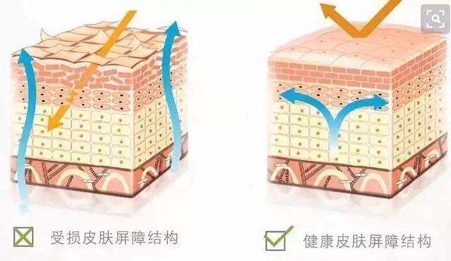 鱼鳞病止痒药膏图片