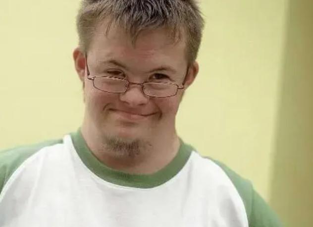 为什么唐氏综合征的孩子，没有“遗传”父母的相貌，长相都差不多