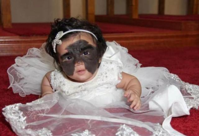 宝宝的胎记到底是哪来的？避免宝宝长胎记，孕期这些行为要避开