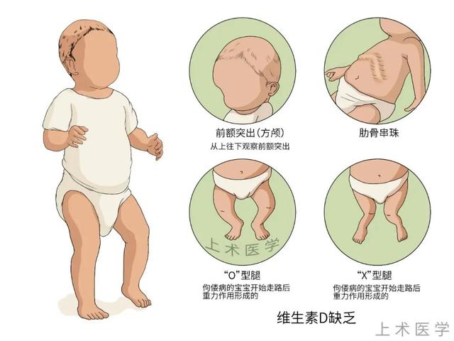 儿童天天服用维生素D有害吗？