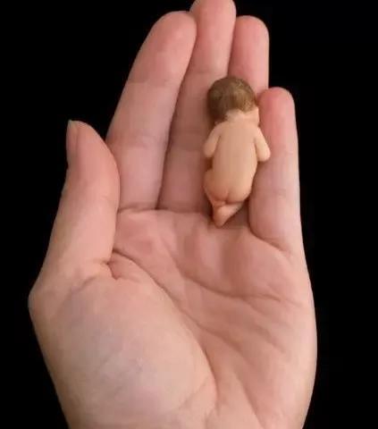 我的妊娠剧吐迎来，新生命