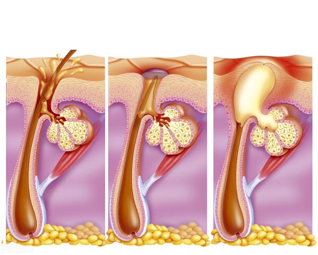 生活中的美容小常识（面部日常保养的5个小知识）