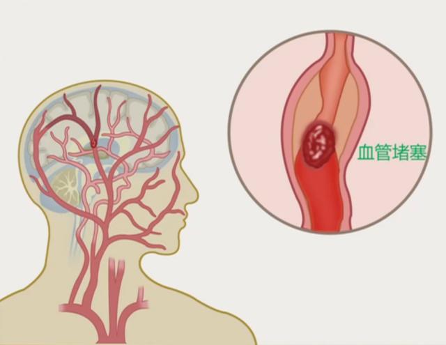 40岁是健康的分水岭！40岁后，最要牢记8个健康关键词