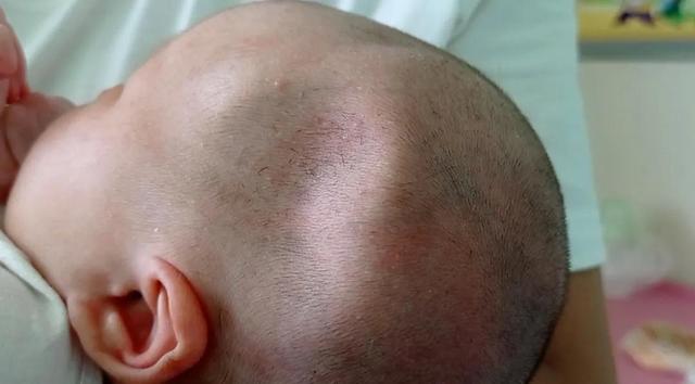 孕妇怀孕生小孩，家人不可以做医盲