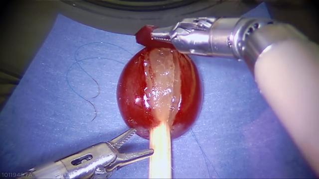 业余时间设计的机械臂给葡萄缝针，华为工程师火了，引无数人膜拜