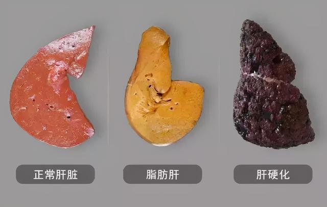 提醒：肝不好的人，这几种水果可以多吃点，或能帮助修复肝功能