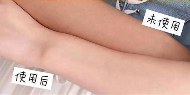 女生冬天腿上为什么会鸡皮肤很痒