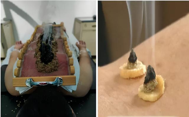 疫情当前，增强免疫是关键！灸“透”这些穴，强身又健体