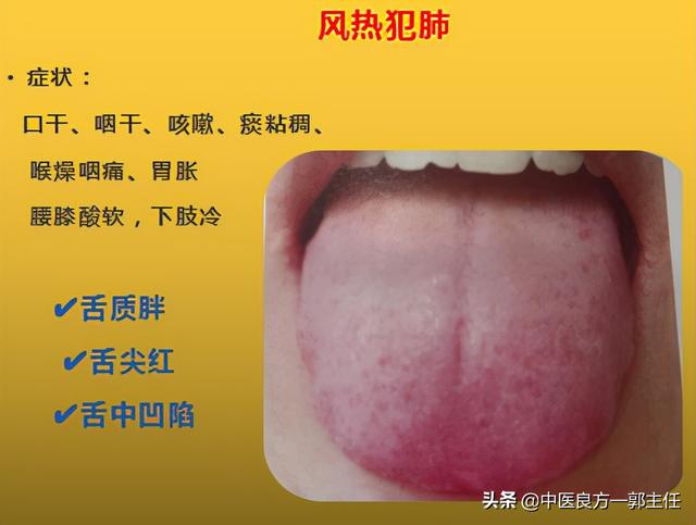 12种“热”藏于体内，反应的舌象、症状各不相同，自查便知