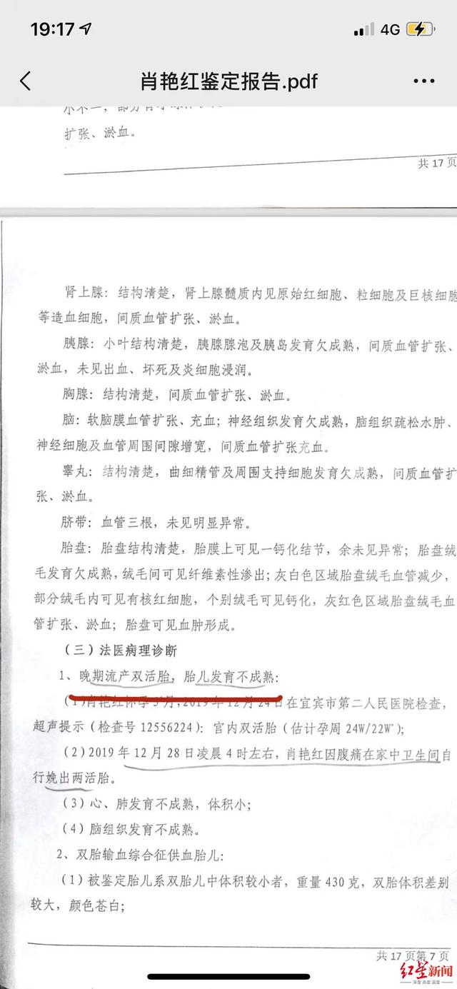 双胞胎流产疑云 调查 孕妇腹痛医院做支架置入术两天后流产家属质疑诊疗不当索赔百万 全网搜