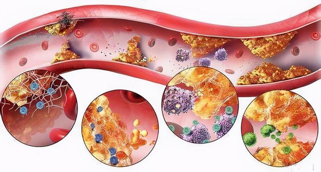 丹参泡水能通血管？这事靠谱吗？听听中医主任医师怎么说