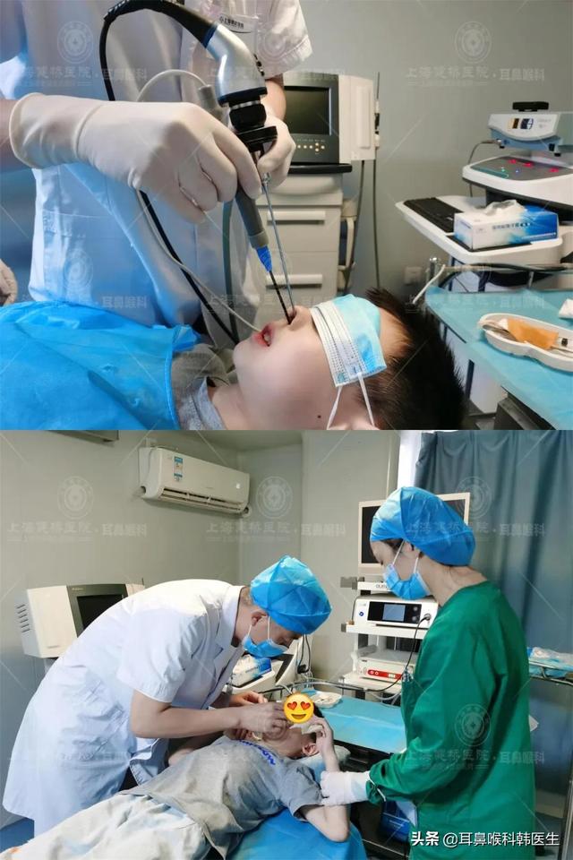 扁桃体角化物多