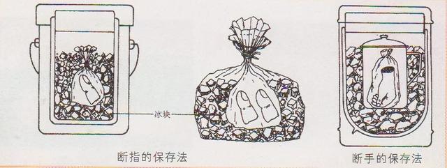破碎机夹断钢板