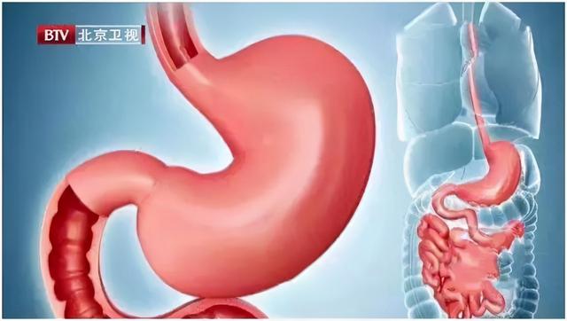 重口胃、细菌胃、弹簧胃，吃出来的“不良胃”，你中招了吗？健康好胃，得这么养