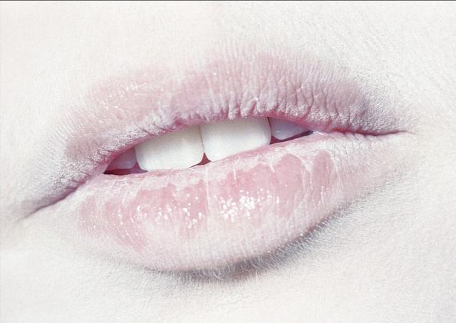 脾胃湿热无血色？医生提醒：做到这些，让你告别脾湿热