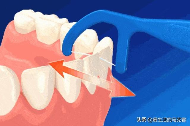 牙线是什么（牙线是什么时候发明的）