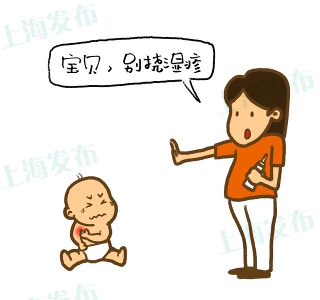 湿疹是否需要多擦身体乳