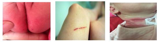 婴儿喂养事件记录（一）