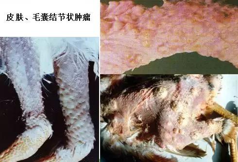 鸡皮肤是绝症么