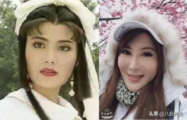 大陶红:折腾脸后颜值大跌的8位女星：多数已过气，有人嘴都歪了