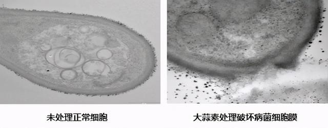 9-10月，柑橘溃疡病反复发作，这样防治用药就对了9