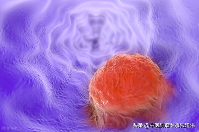 確診良性腫瘤也不能松懈，做好這幾點可以防止癌變