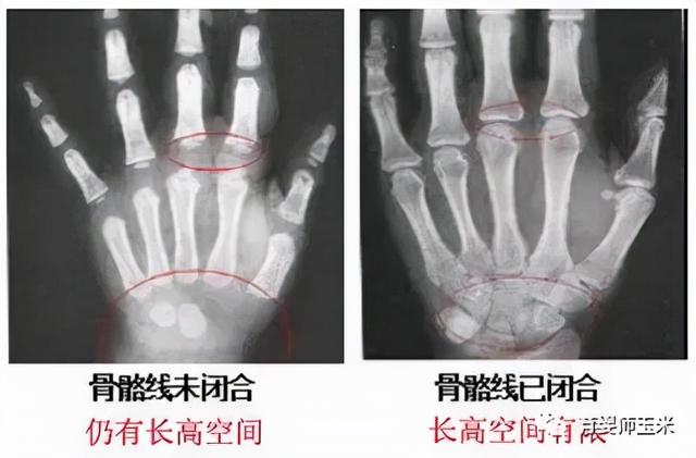 想预测孩子以后能长多高？教你4种计算方法