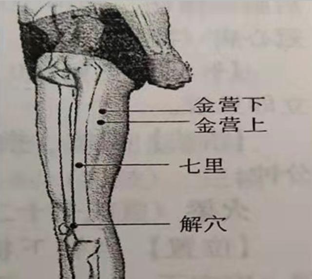 中医针灸肩部疾病处方1