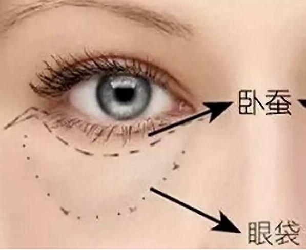 卧蚕,眼袋,傻傻分不清楚?其实并不难区分