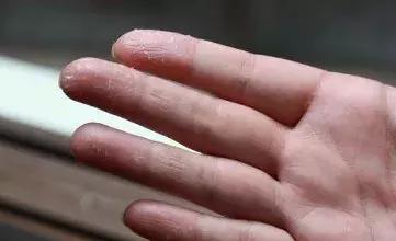 在身体乳里加茶油