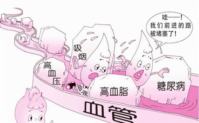 心血管疾病的自我预防和改善