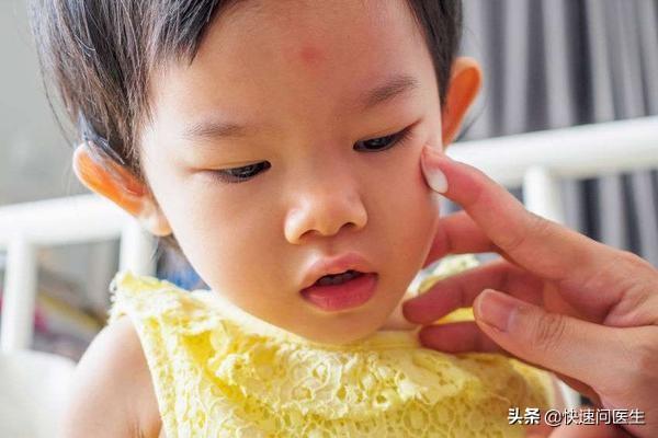 婴儿湿疹涂乳膏对身体有伤害吗