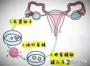 试管婴儿究竟是怎样的“试管”过程，需要注意什么事项？