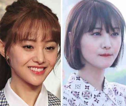 郑爽的鼻子新变化(郑爽以前现在的对比照)