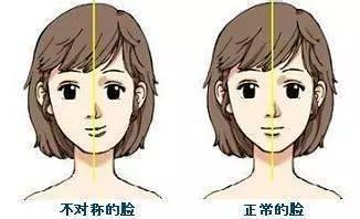 暴牙怎么办