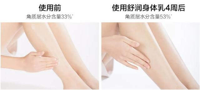 身体乳过敏涂什么药膏止痒