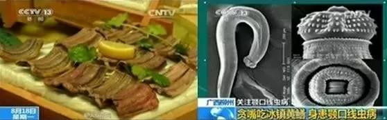小孩鸡皮疙瘩白皮