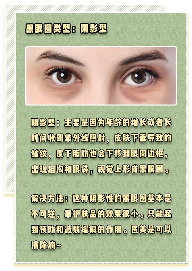 维a酸加入身体乳