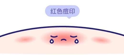 dr.wu杏仁酸精华身体乳