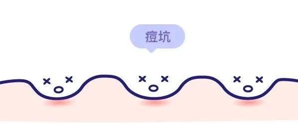 dr.wu杏仁酸精华身体乳