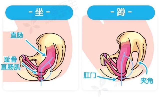 便秘怎么办快速排便