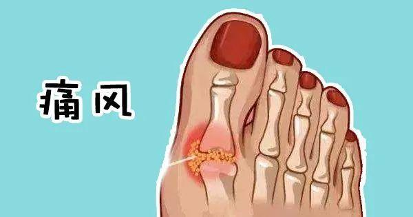 痛风不能吃豆制品，却能以茶代水，怎么回事？正解在这里