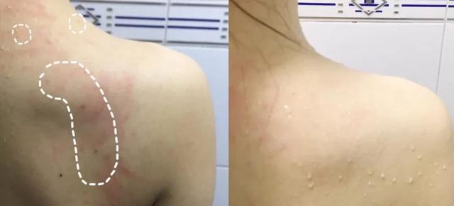 霍霍巴油能当身体乳用吗 霍霍巴油能当身体乳用吗