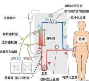 东营超滤膜过滤机作用