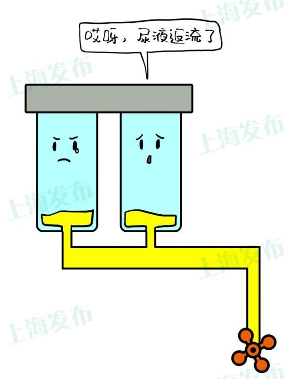 精粉过滤机