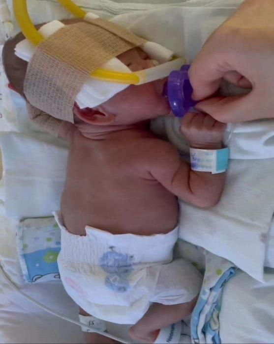 体重最低时仅910克！崇州“巴掌宝宝”闯关75天后，如今快5斤啦