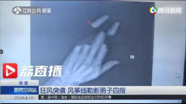 好几个孩子被划伤！假期出游，一定要警惕这个“空中杀手”