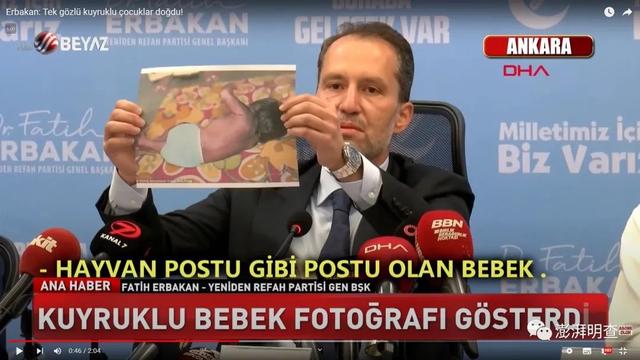 明查｜接种新冠疫苗后孕妇会生下长尾巴的畸形婴儿？